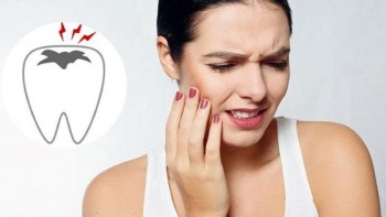 Các cách chữa đau răng tại nhà bạn đã biết?