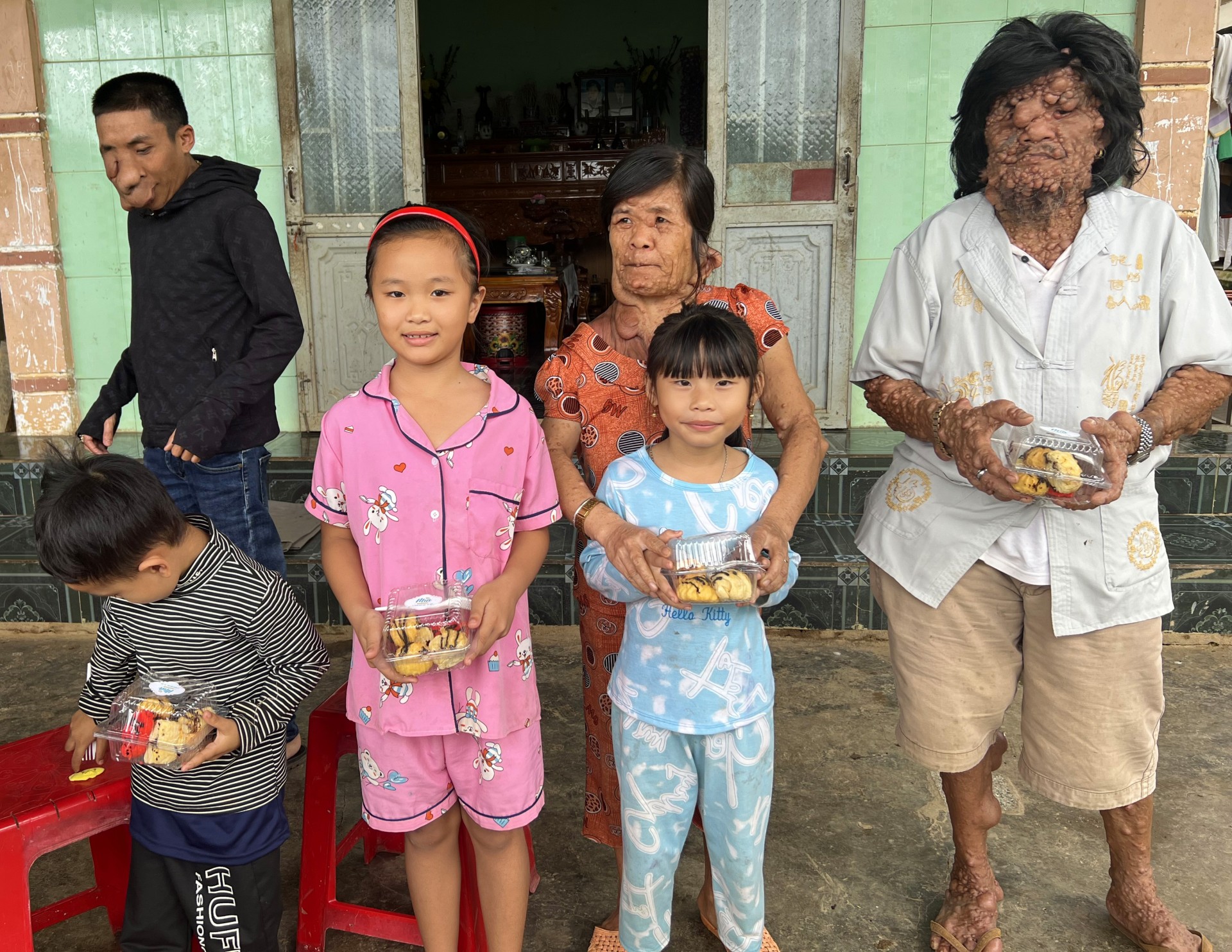 Đắk Lắk: Xin hãy cứu giúp 3 bố con ông Tê mắc chứng bệnh lạ