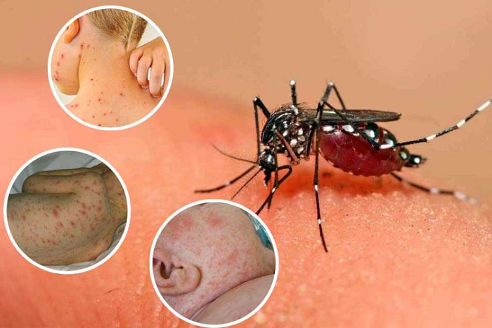Tăng cường phòng bệnh sốt xuất huyết bằng chiến dịch diệt muỗi, diệt lăng quăng