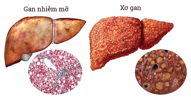 Trứng là thực phẩm tốt, nhưng ăn bao nhiêu là đủ?