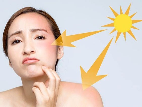 Kem chống nắng giúp làn da ngăn ngừa tia UV