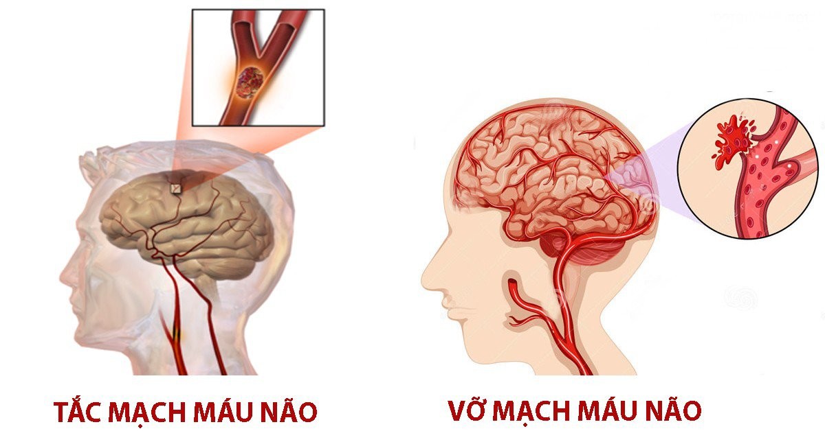 Ăn thịt chó có thể nhiễm bệnh gì?