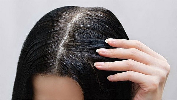 Tóc bạc sớm, có nên nhuộm tóc phủ bạc hay không?