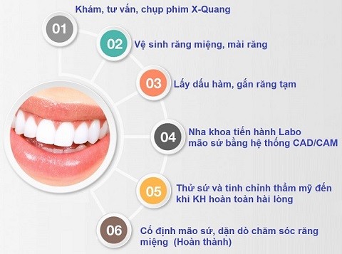 Một số quy trình làm răng sứ
