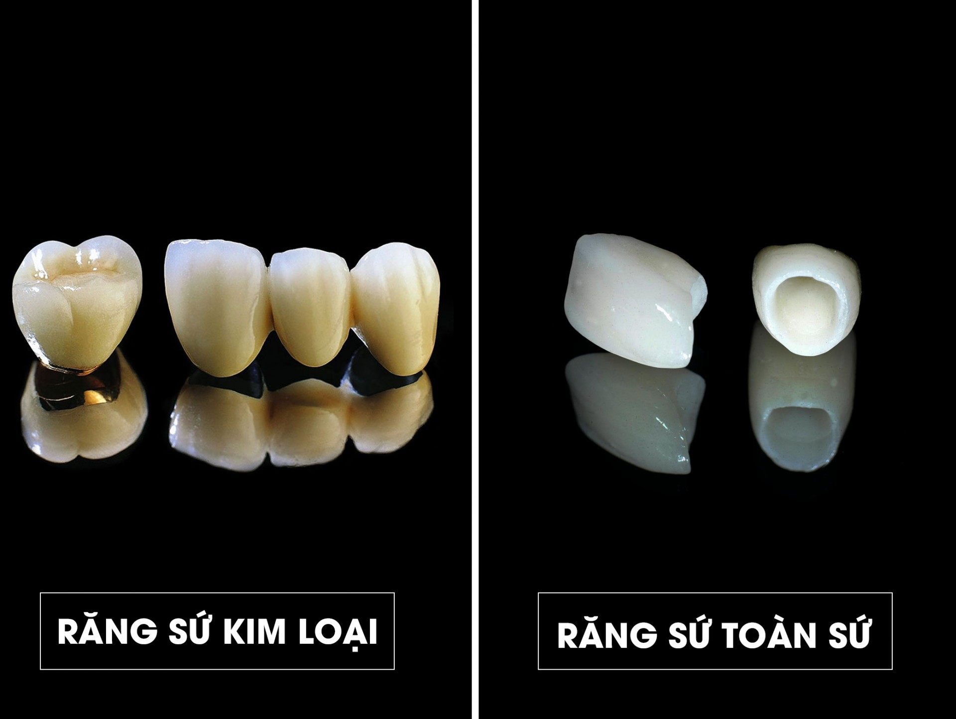 Vật liệu sử dụng răng sứ được chia thành 2 loại: răng sứ kim loại và răng toàn sứ