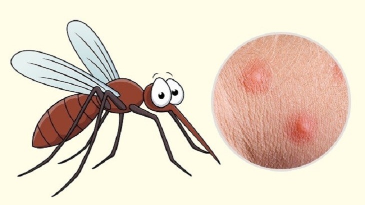 Mách bạn mẹo chống muỗi đốt đơn giản hiệu quả tại nhà