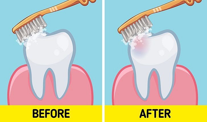 Đánh răng trước hay sau khi ăn sáng, nha sĩ khuyên gì?