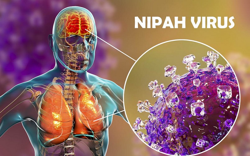 Thông tin về Virus Nipah có tỷ lệ tử vong cao gấp 20 lần COVID -19