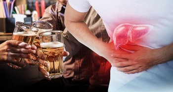 Uống bia ảnh hưởng như thế nào đến sức khoẻ?