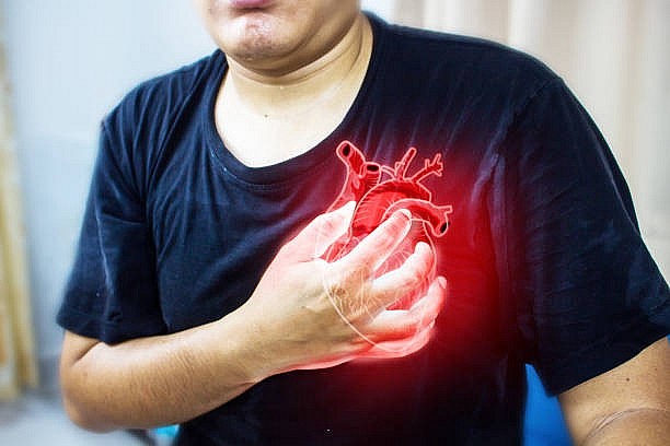 Bệnh tim mạch là nguyên nhân gây tử vong nhiều nhất hiện nay