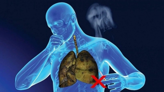 Bạn có đang vô tình làm tổn thương phổi của mình?
