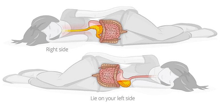 Khi ngủ nên nằm nghiêng bên nào?