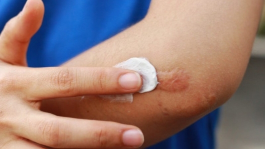 Khám phá những công dụng thú vị của kem đánh răng