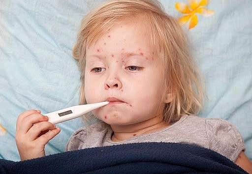 Số ca sởi tăng nhanh, cần chủ động phòng ngừa sởi bằng vaccine