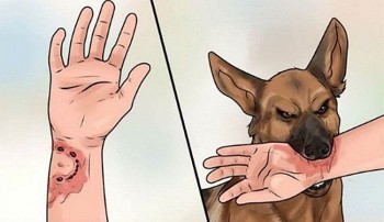 Cảnh báo nguy cơ gia tăng bệnh dại trong mùa hè