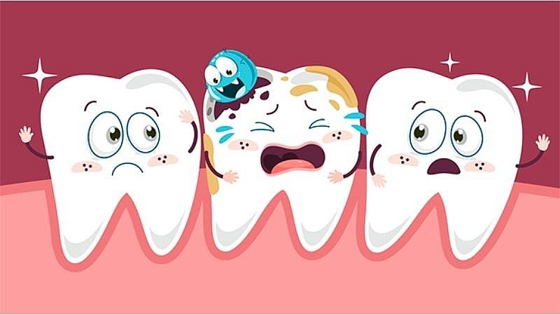 Sâu răng là một trong những nguyên nhân hàng đầu gây hôi miệng.