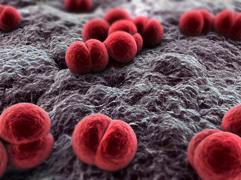 Viêm não mô cầu do vi khuẩn Neisseria meningitidis gây ra có thể dẫn đến viêm màng não và nhiễm trùng huyết.