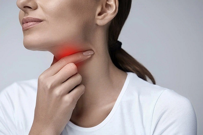 Viêm họng cấp là tình trạng viêm niêm mạc họng kéo dài dưới 4 tuần.