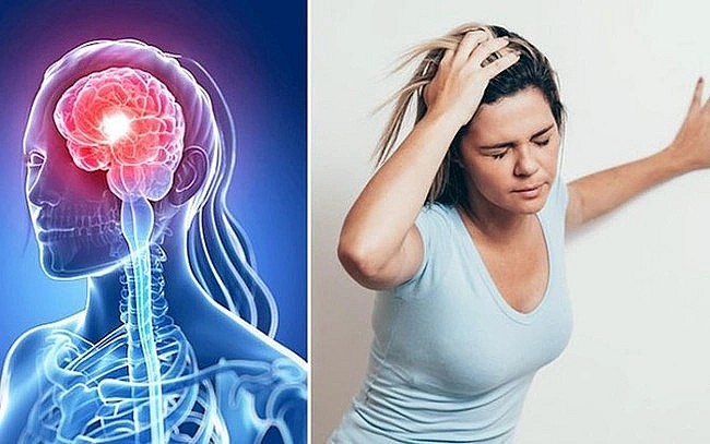 Đột quỵ thường đến bất ngờ, nhưng hoàn toàn có thể phòng ngừa bằng cách thay đổi lối sống.