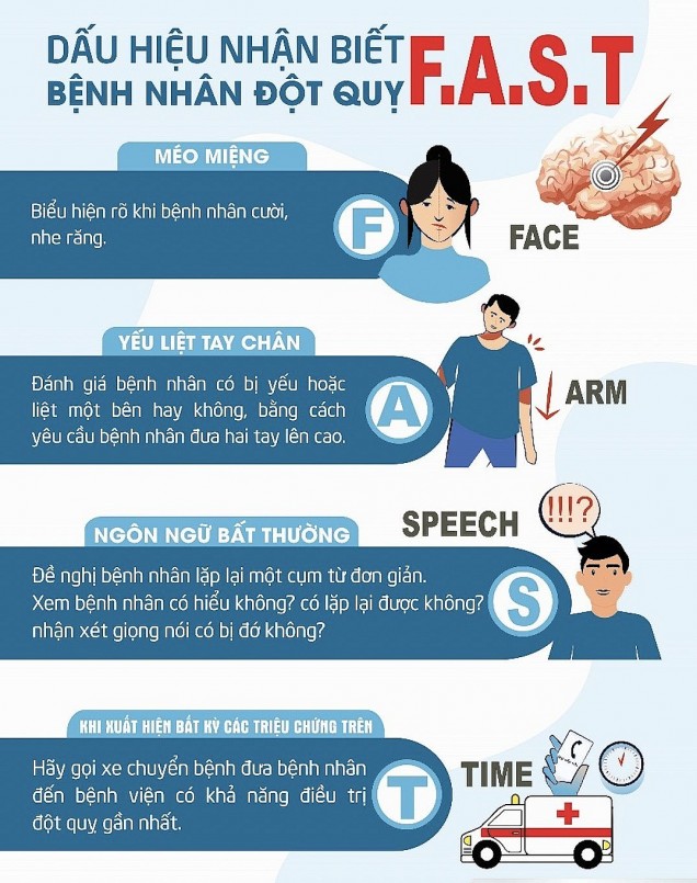 Chóng mặt đi kèm dấu hiệu theo quy tắc FAST có thể là biểu hiện đột quỵ – cần cấp cứu ngay lập tức.