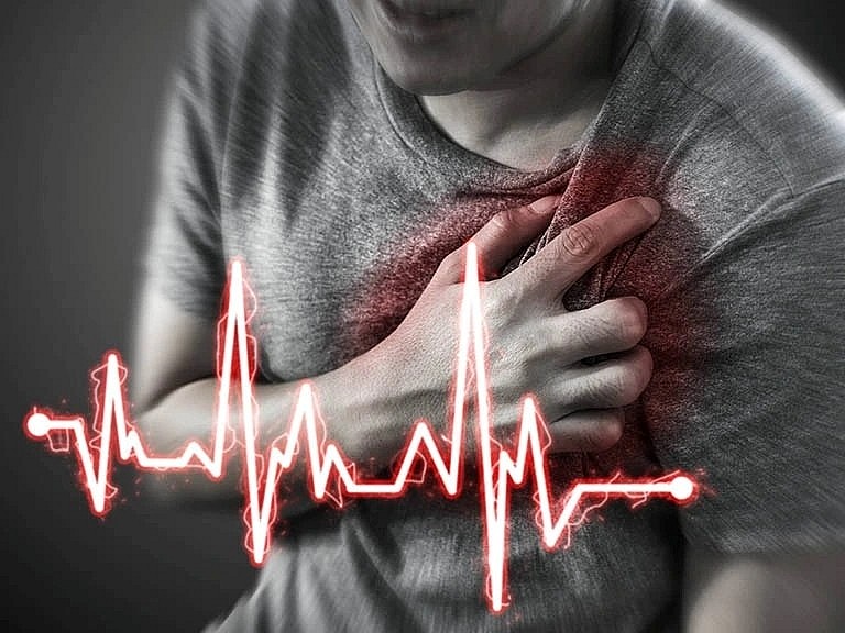 Ngừng tim đột ngột khiến tim mất khả năng bơm máu,.
