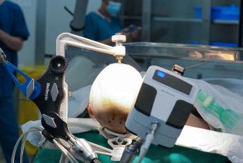 Vinmec tiên phong điều trị động kinh bằng Robot định vị thần kinh hàng đầu thế giới