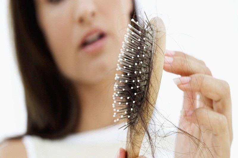 Giải mã nguyên nhân và dấu hiệu sớm của rụng tóc từng mảng