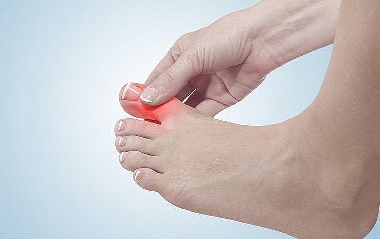 Lạm dụng nước hầm xương có thể làm tăng axit uric, dẫn đến bệnh gút và viêm khớp cấp.