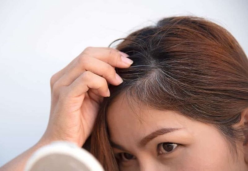 Nhiều người trẻ phát hiện tóc bạc khi mới ngoài 20 tuổi – tình trạng không còn hiếm gặp trong cuộc sống hiện đại.