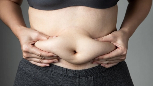 Mỡ bụng: “Sát thủ thầm lặng” làm tăng nguy cơ đột quỵ