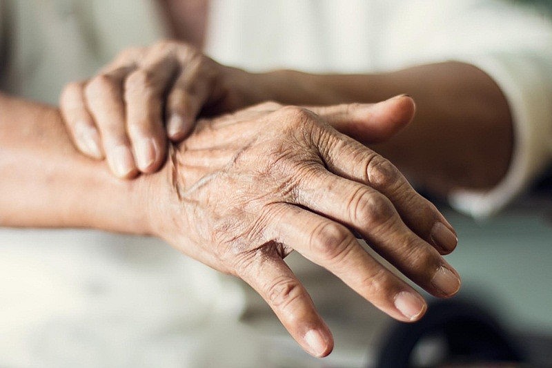 Các vấn đề vận động của bệnh Parkinson thường khởi phát một cách âm thầm, dễ bị bỏ qua hoặc nhầm lẫn với quá trình lão hóa tự nhiên.