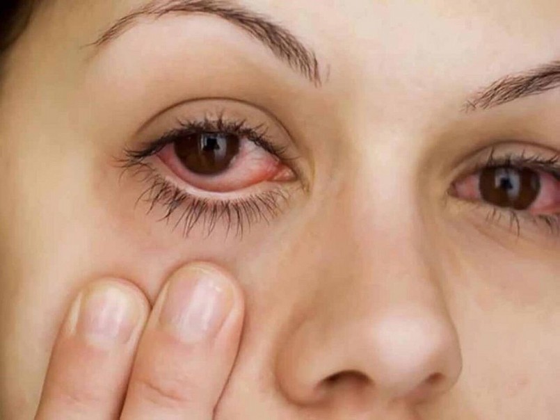 Ánh sáng xanh từ màn hình điện thoại có thể gây khô mắt, tổn thương võng mạc và đẩy nhanh quá trình thoái hóa điểm vàng.