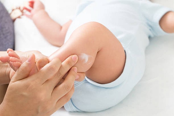 Dưỡng ẩm đều đặn giúp củng cố hàng rào bảo vệ da, hạn chế bùng phát viêm da cơ địa khi đi du lịch.