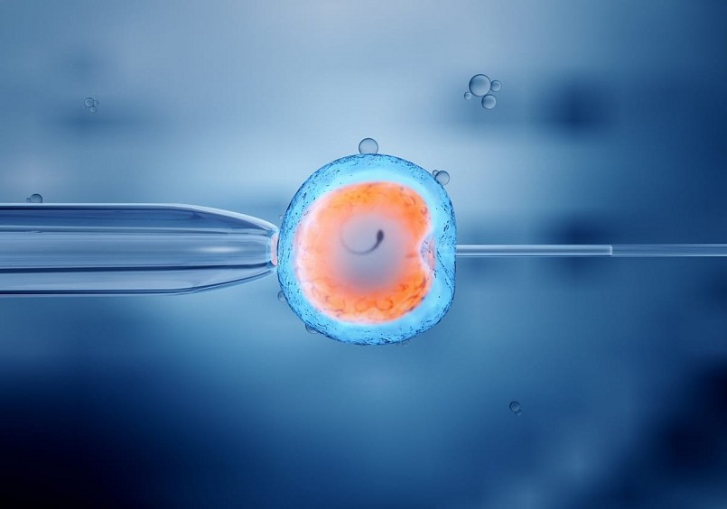 Thụ tinh trong ống nghiệm (IVF).