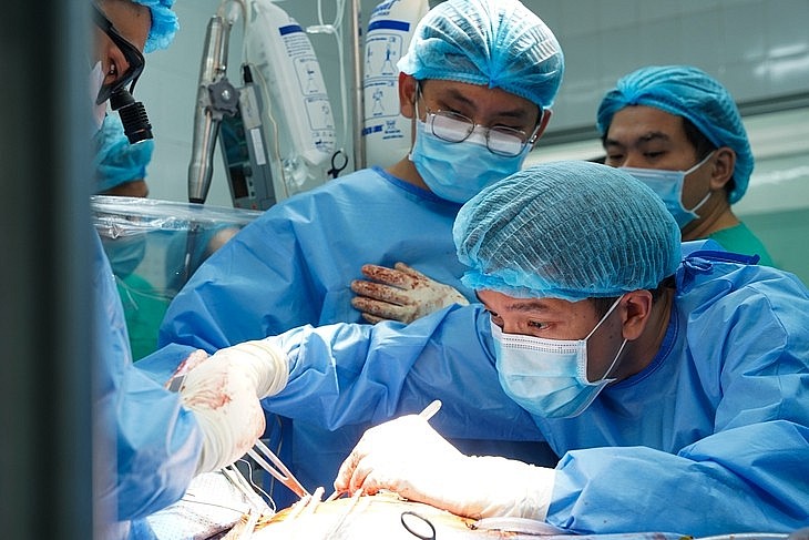 Ê-kíp ghép tim cho bệnh nhân suy tim nặng. Ảnh: BVCC