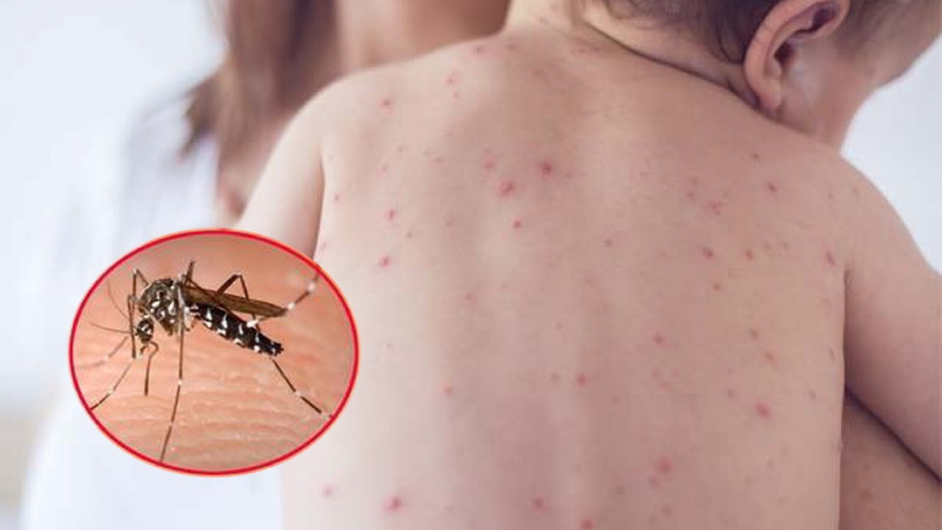 Y tế cuối năm 2025: Đối mặt thách thức “dịch chồng dịch”