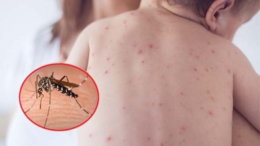 Y tế cuối năm 2025: Đối mặt thách thức “dịch chồng dịch”