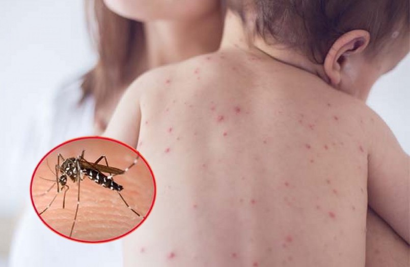 Chỉ riêng trong tháng 10, cả nước đã ghi nhận 24.250 trường hợp mắc sốt xuất huyết, trong đó có 6 ca tử vong. Chỉ riêng trong tháng 10, cả nước đã ghi nhận 24.250 trường hợp mắc sốt xuất huyết, trong đó có 6 ca tử vong.