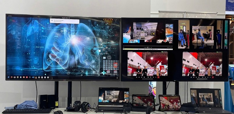 Phần mềm ứng dụng AI trong chẩn đoán ung thư phổi của Bệnh viện Bạch Mai.