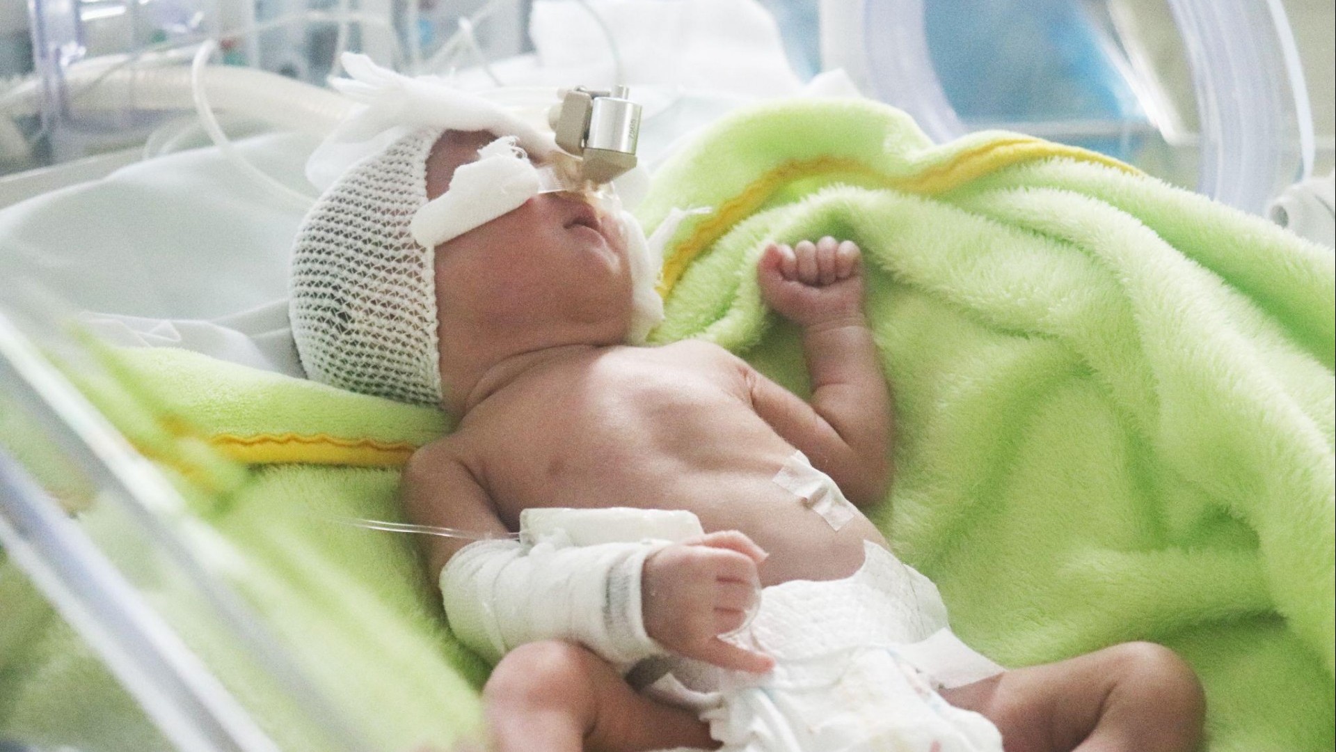 Bộ Y tế dồn lực giảm tỷ lệ tử vong do sinh non