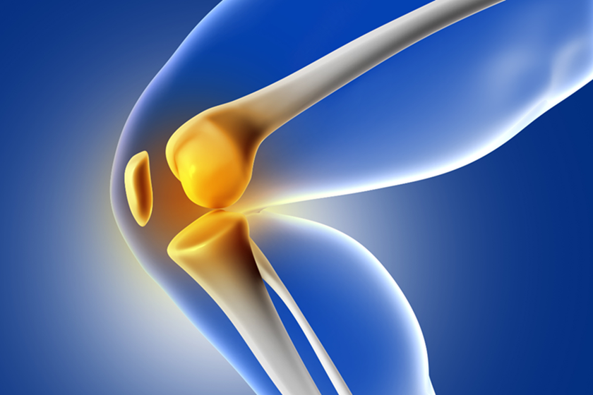 Thoái hóa khớp nếu không được điều trị hiệu quả có thể gây biến dạng khớp, làm tăng nguy phải thay khớp (Ảnh: Freepik.com) Thoái hóa khớp nếu không được điều trị hiệu quả có thể gây biến dạng khớp, làm tăng nguy phải thay khớp (Ảnh: Freepik.com)