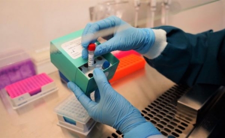 Bộ VinKit SARS-CoV-2 Multiplex RT-PCR có khả năng tích hợp phản ứng ‘3 trong 1’